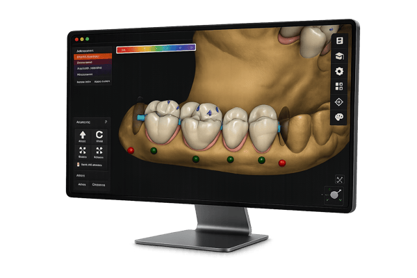 Diseño dental digital dentflow-1