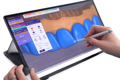 Diseño dental digital en dentflow