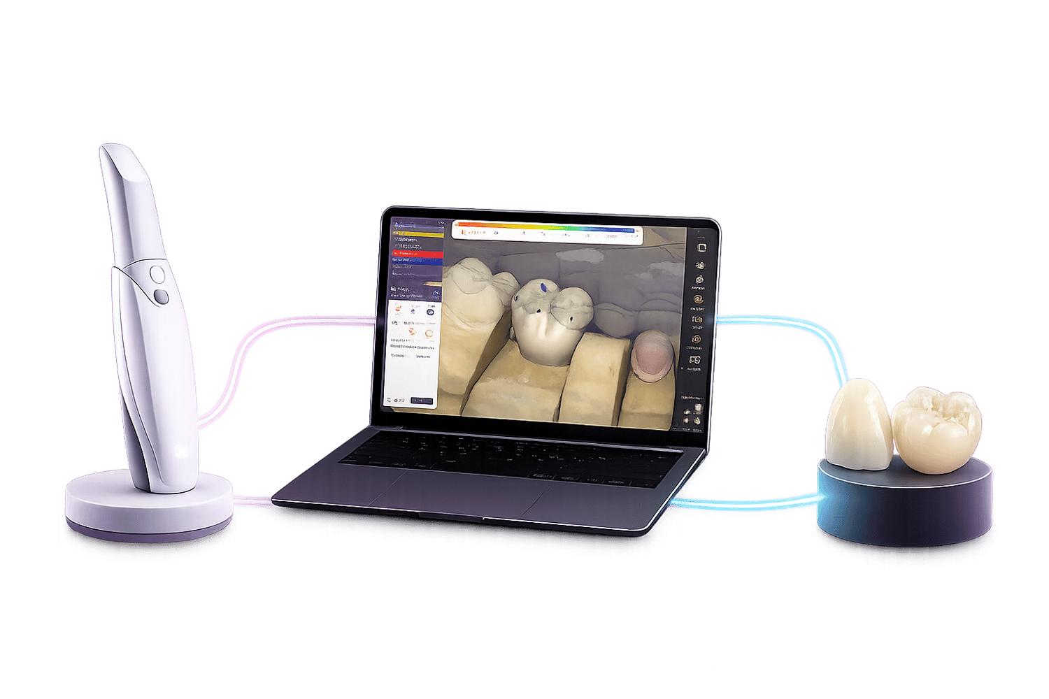 escaneo-intraoral y-diseno-cad-dental